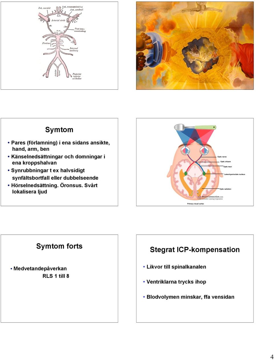 Svårt lokalisera ljud Optic nerve Optic chiasm Optic tract Lateral geniculate nucleus Optic radiation Primary visual