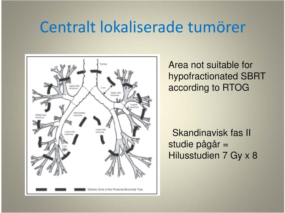 SBRT according to RTOG Skandinavisk