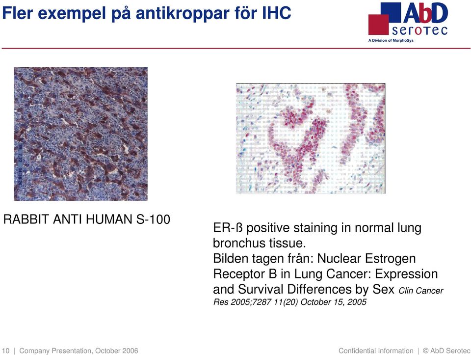 Bilden tagen från: Nuclear Estrogen Receptor B in Lung Cancer: Expression and Survival