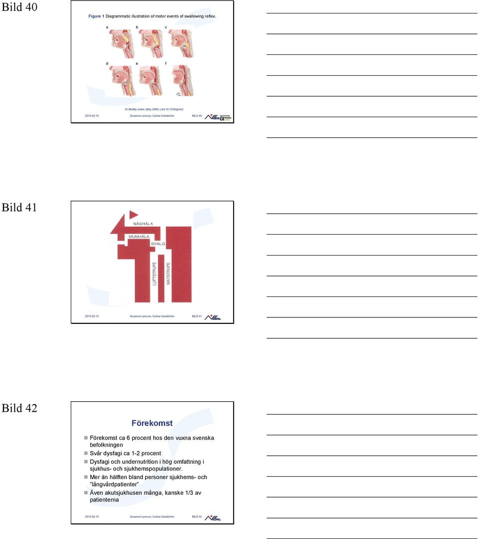 Förekomst ca 6 procent hos den vuxna svenska befolkningen Svår dysfagi ca 1-2 procent Dysfagi och undernutrition i hög omfattning i sjukhus- och