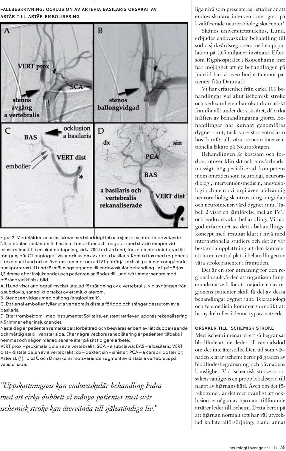 På en akutmottagning, cirka 200 km från Lund, förs patienten intuberad till röntgen, där CT-angiografi visar ocklusion av arteria basilaris.