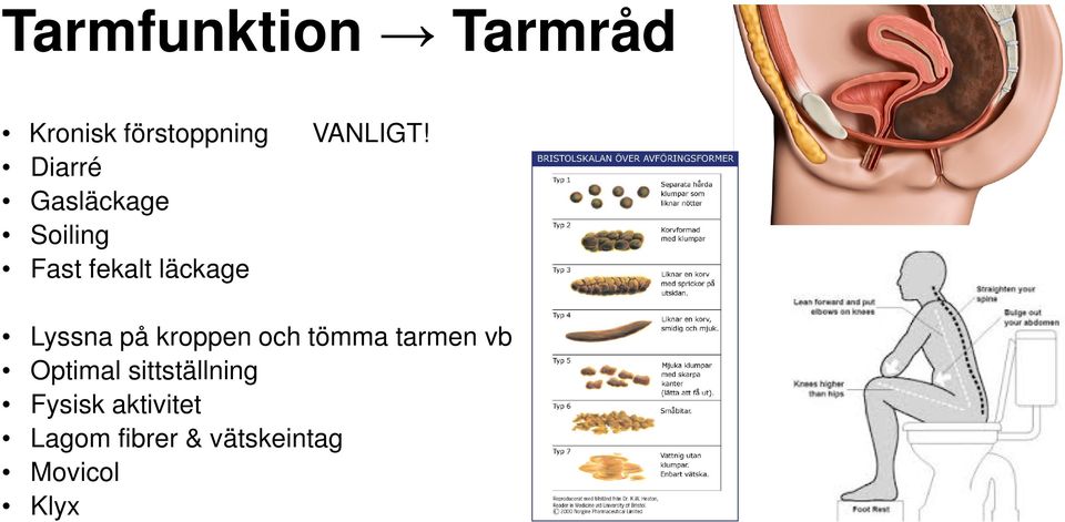 på kroppen och tömma tarmen vb Optimal sittställning