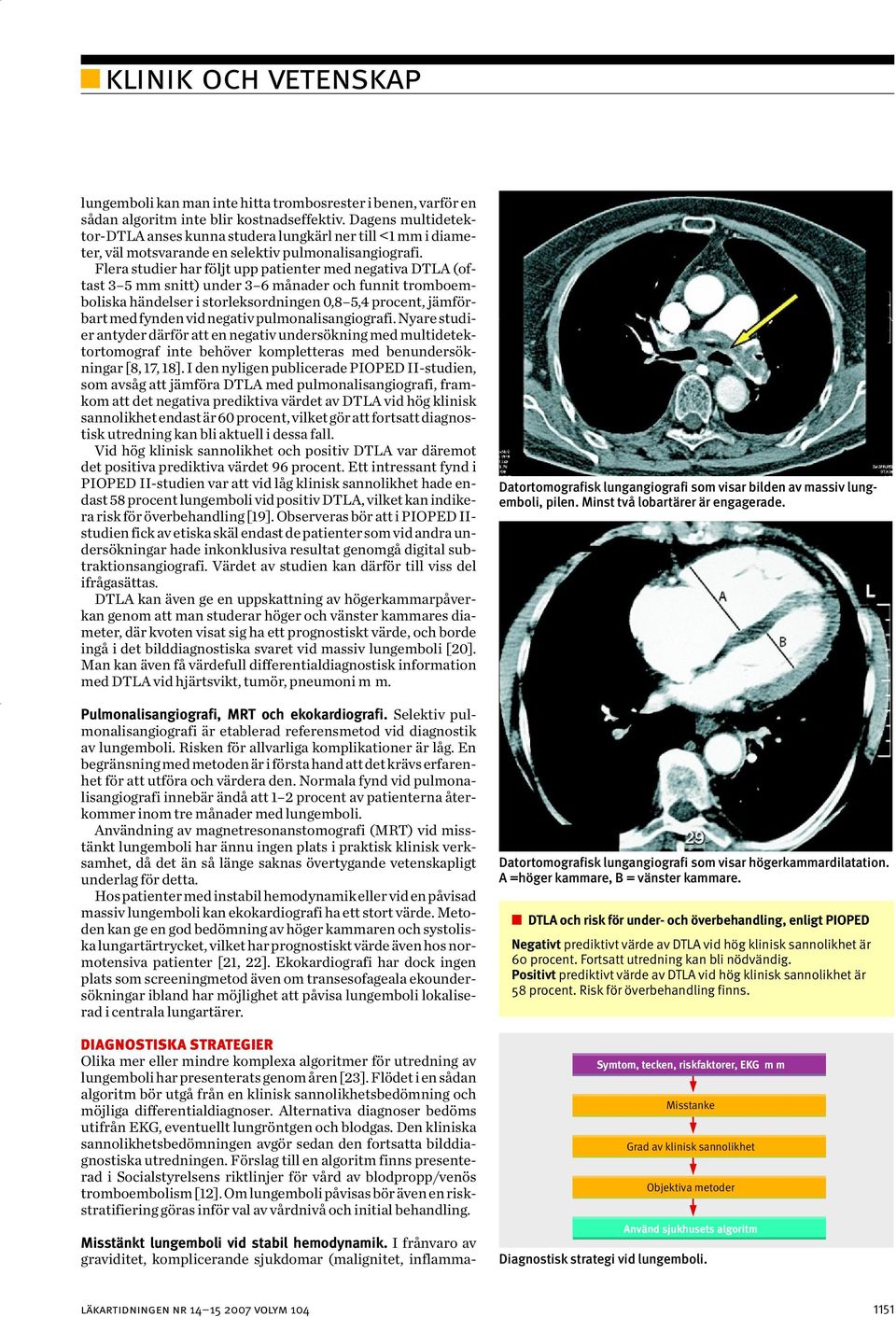 Dagens multidetektor-dtla anses kunna studera lungkärl ner till <1 mm i diameter, väl motsvarande en selektiv pulmonalisangiografi.