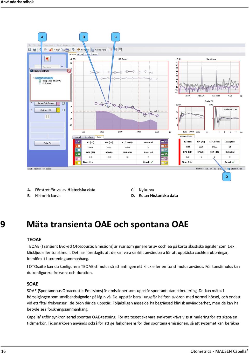 klickljud eller tonstimuli. Det har föreslagits att de kan vara särskilt användbara för att upptäcka cochlearubbningar, framförallt i screeningsammanhang.