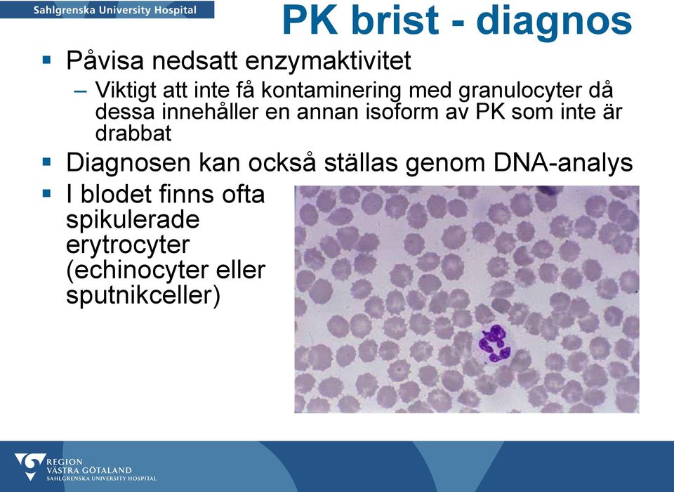 PK som inte är drabbat Diagnosen kan också ställas genom DNA-analys I