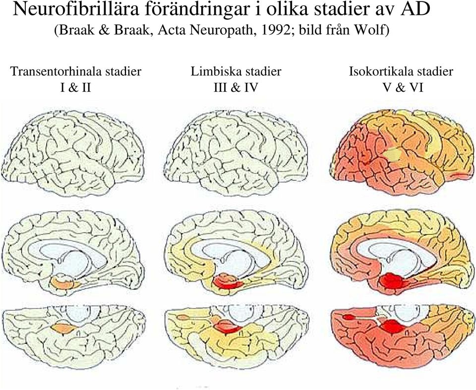 från Wolf) Transentorhinala stadier I & II