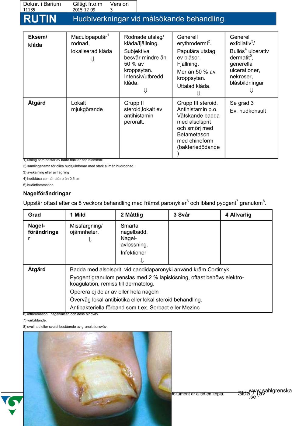 Intensiv/utbredd klåda. Grupp II steroid,lokalt ev antihistamin peroralt. Generell erythrodermi 2. Papulära utslag ev blåsor. Fjällning. Mer än 50 % av kroppsytan. Uttalad klåda. Grupp III steroid.