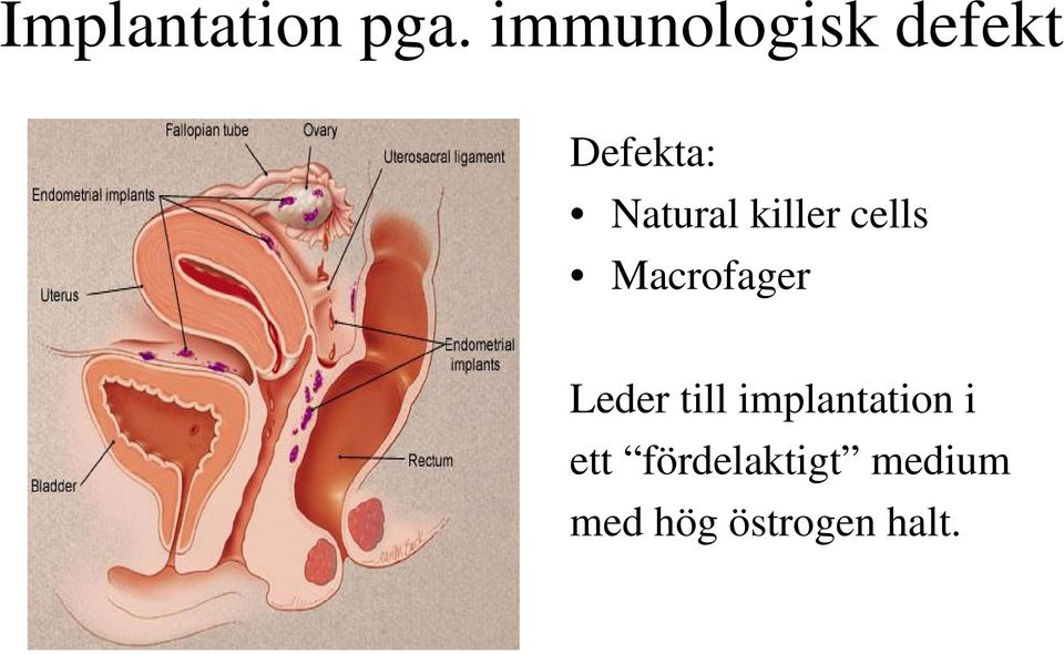 killer cells Macrofager Leder till