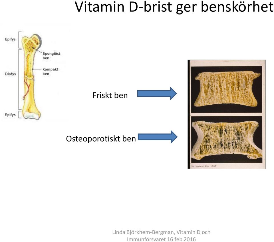 benskörhet