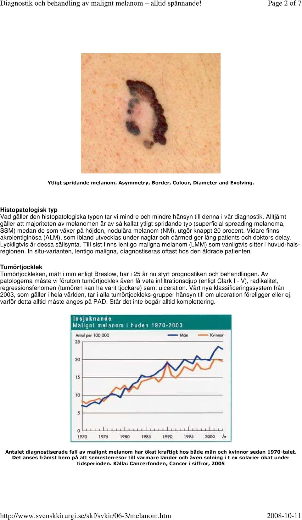 Alltjämt gäller att majoriteten av melanomen är av så kallat ytligt spridande typ (superficial spreading melanoma, SSM) medan de som växer på höjden, nodulära melanom (NM), utgör knappt 20 procent.