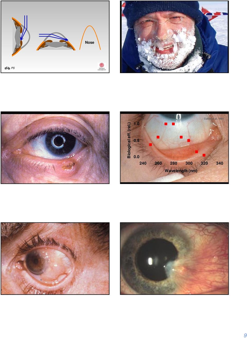 ) Pcn IncreasedSecretion Cullen et al, 994.