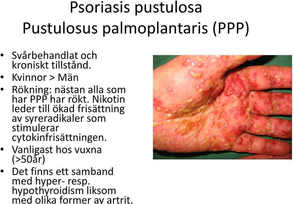 Nikotin leder till ökad frisättning av syreradikaler som stimulerar cytokinfrisättningen.