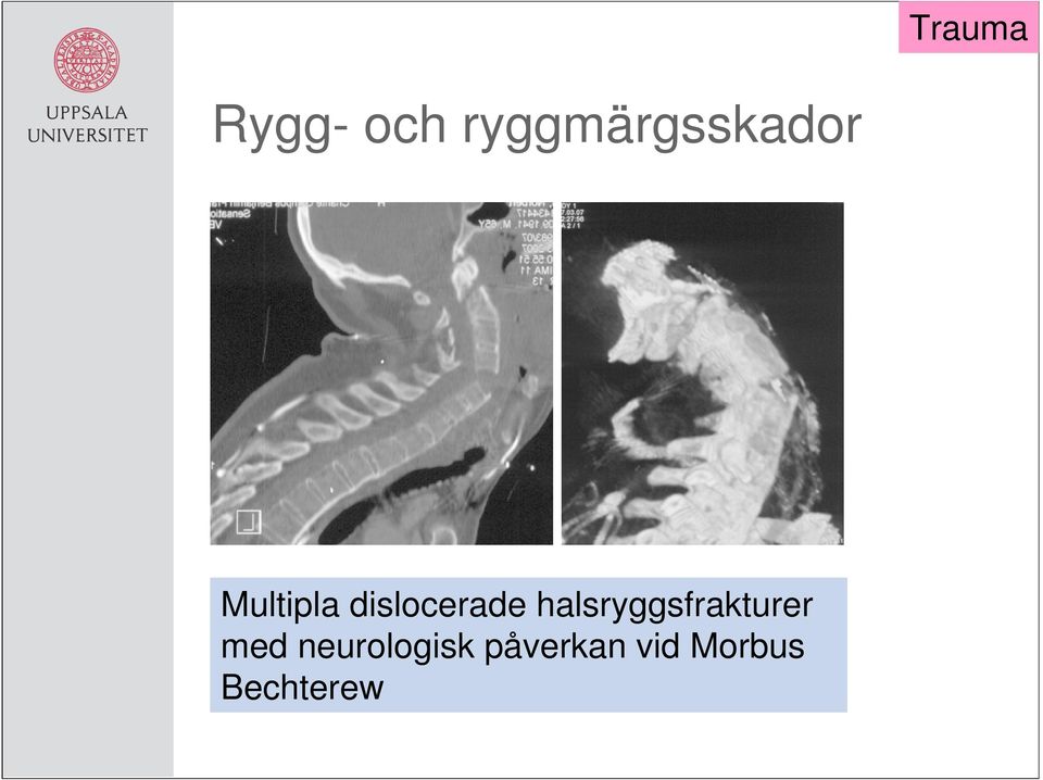 halsryggsfrakturer med