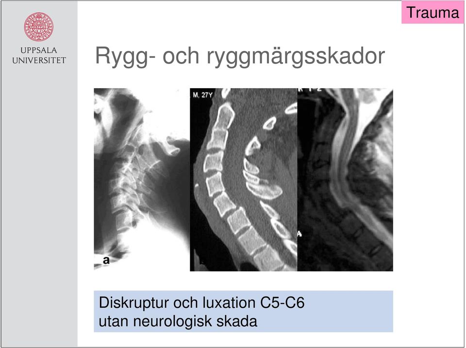 Diskruptur och