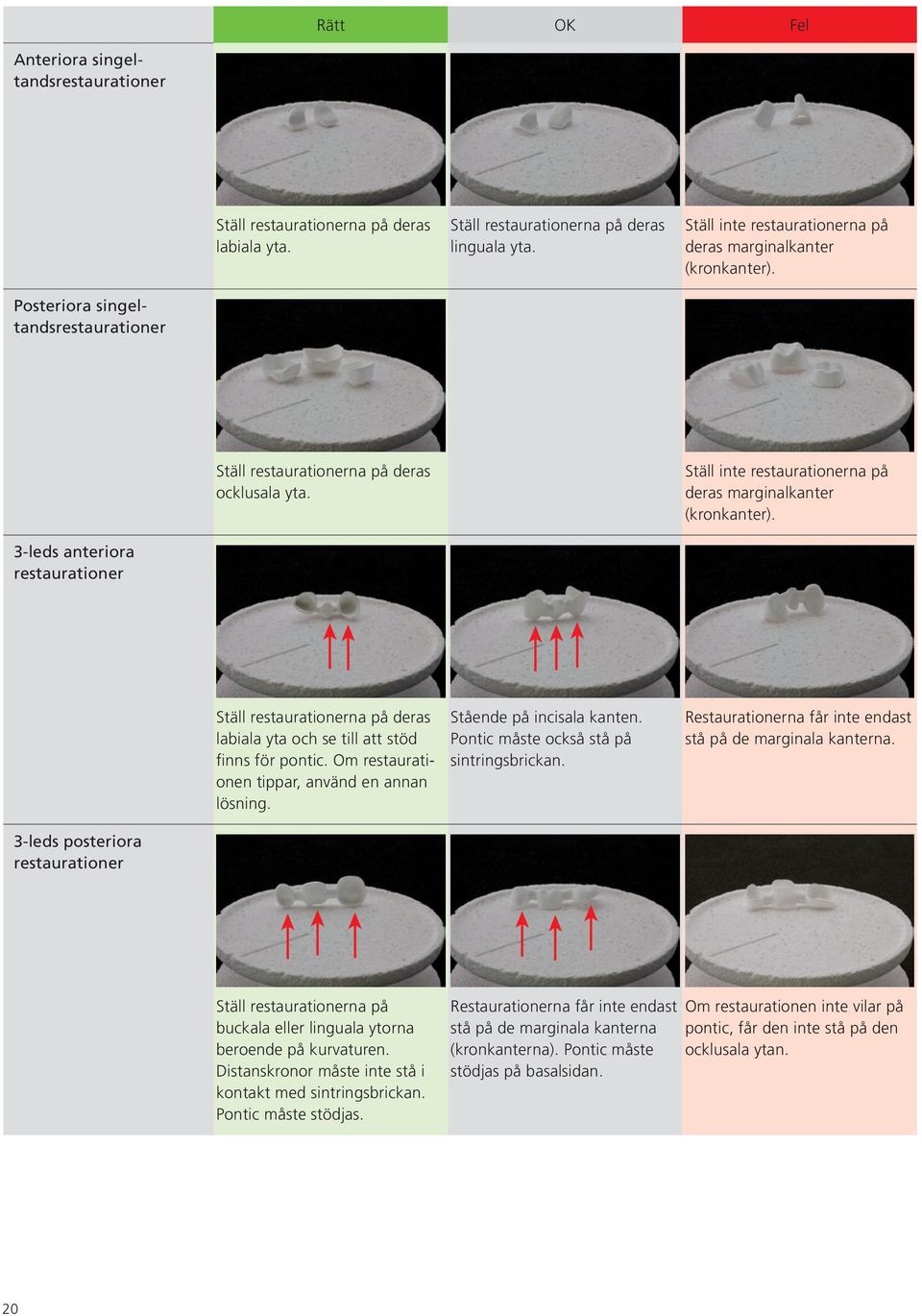 Ställ inte restaurationerna på deras marginalkanter (kronkanter). 3-leds anteriora restaurationer Ställ restaurationerna på deras labiala yta och se till att stöd finns för pontic.
