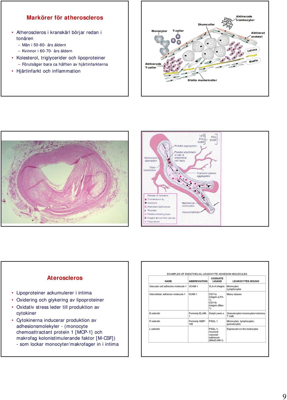 Lipoproteiner ackumulerer i intima Oxidering och glykering av lipoproteiner Oxidativ stress leder till produktion av cytokiner Cytokinerna inducerar produktion av adhesionsmolekyler - (monocyte