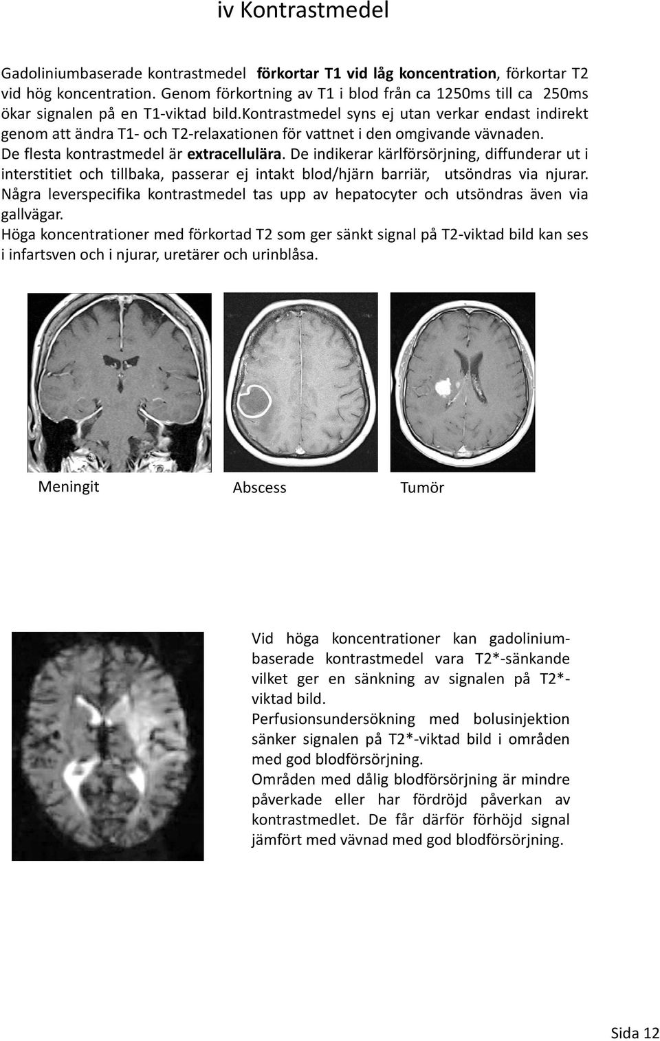 kontrastmedel syns ej utan verkar endast indirekt genom att ändra T1 och T2 relaxationen för vattnet i den omgivande vävnaden. De flesta kontrastmedel är extracellulära.