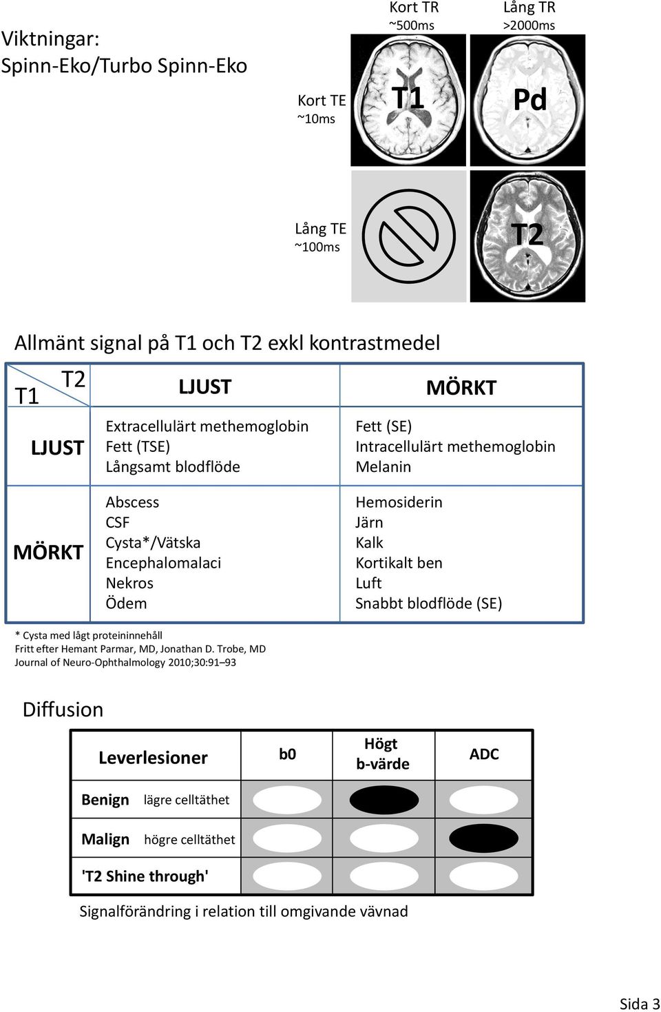 Hemosiderin Järn Kalk Kortikalt ben Luft Snabbt blodflöde (SE) * Cysta med lågt proteininnehåll Fritt efter Hemant Parmar, MD, Jonathan D.