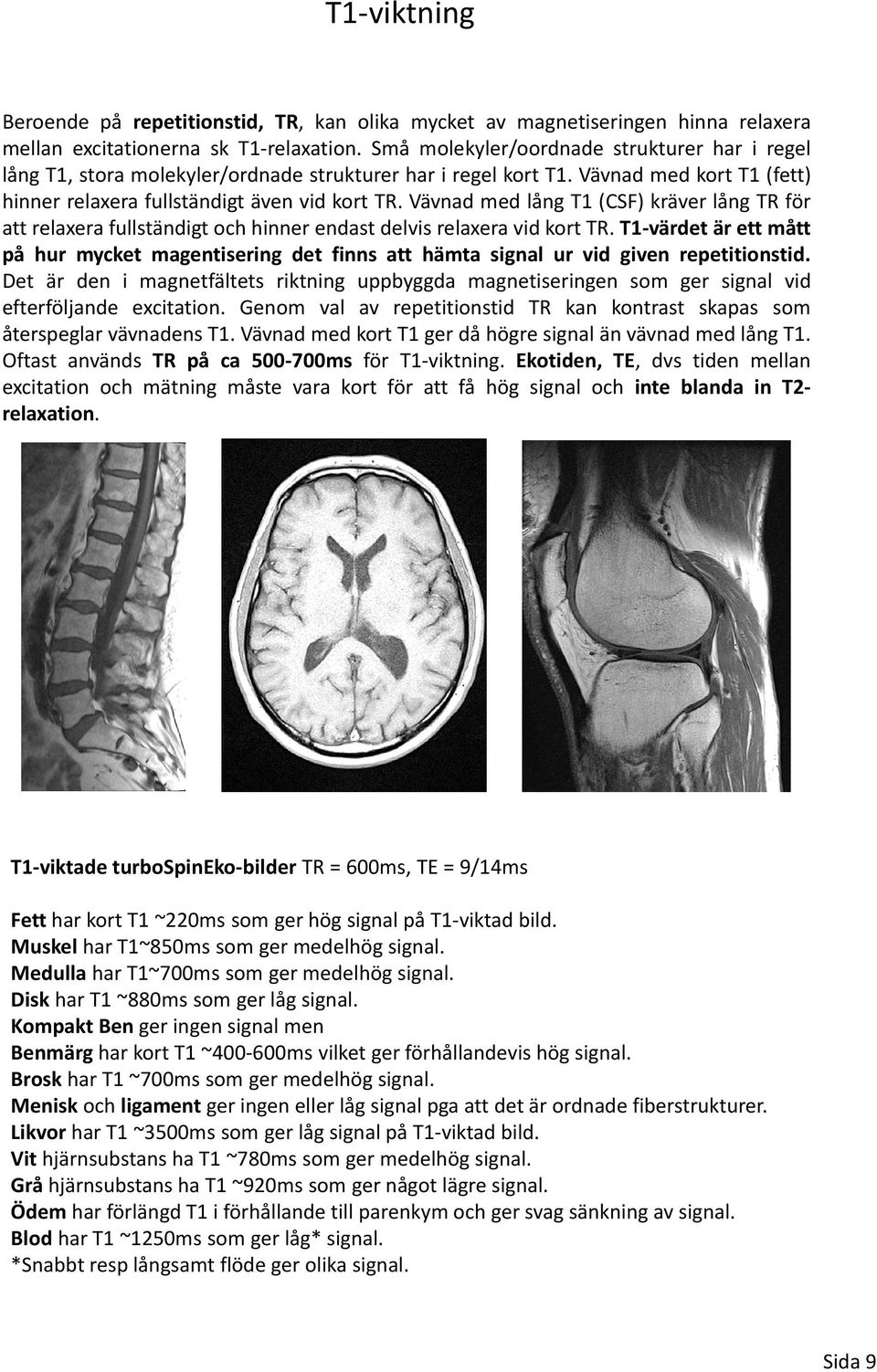 Vävnad med lång T1 (CSF) kräver lång TR för att relaxera fullständigt och hinner endast delvis relaxera vid kort TR.