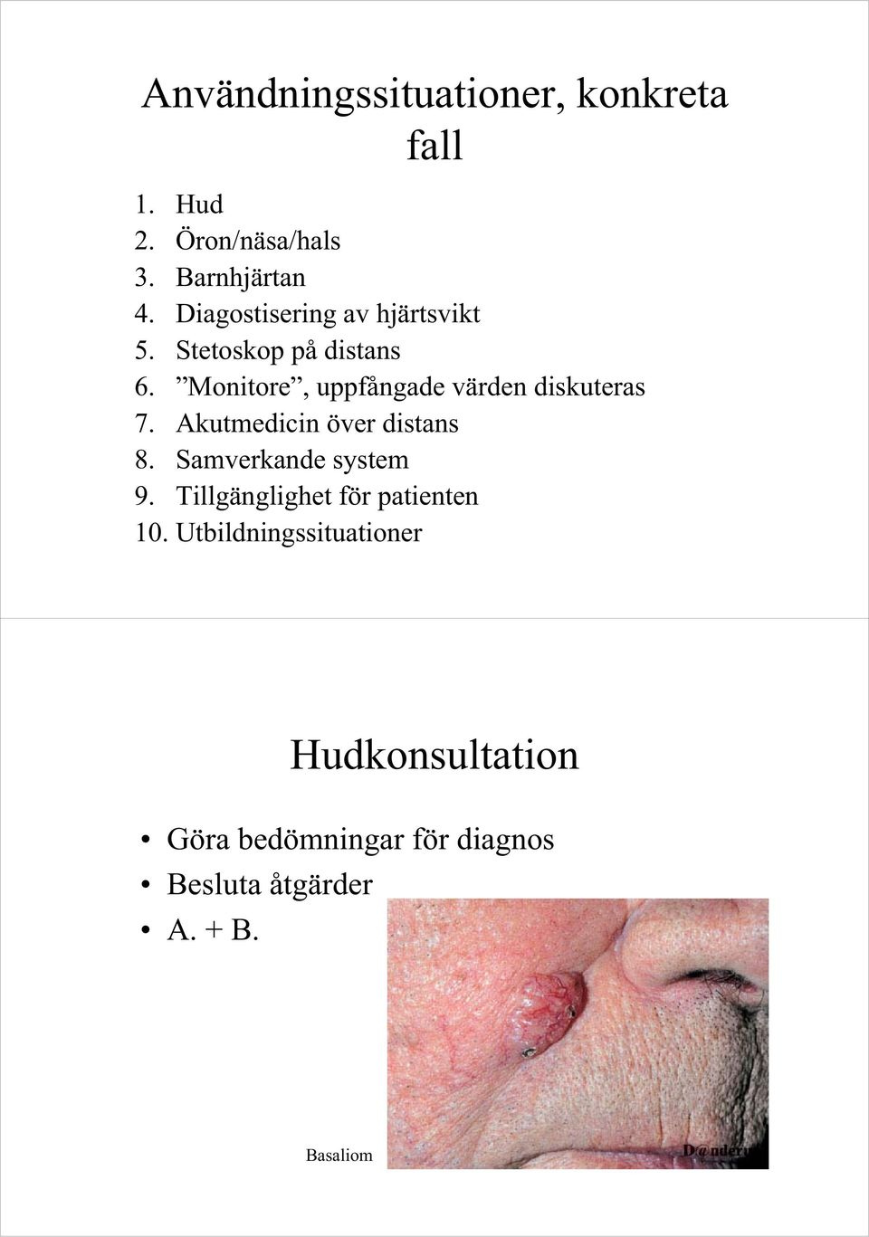 Monitore, uppfångade värden diskuteras 7. Akutmedicin över distans 8. Samverkande system 9.