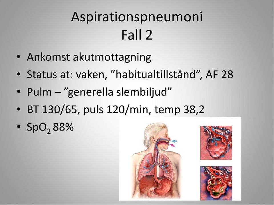 habitualtillstånd, AF 28 Pulm