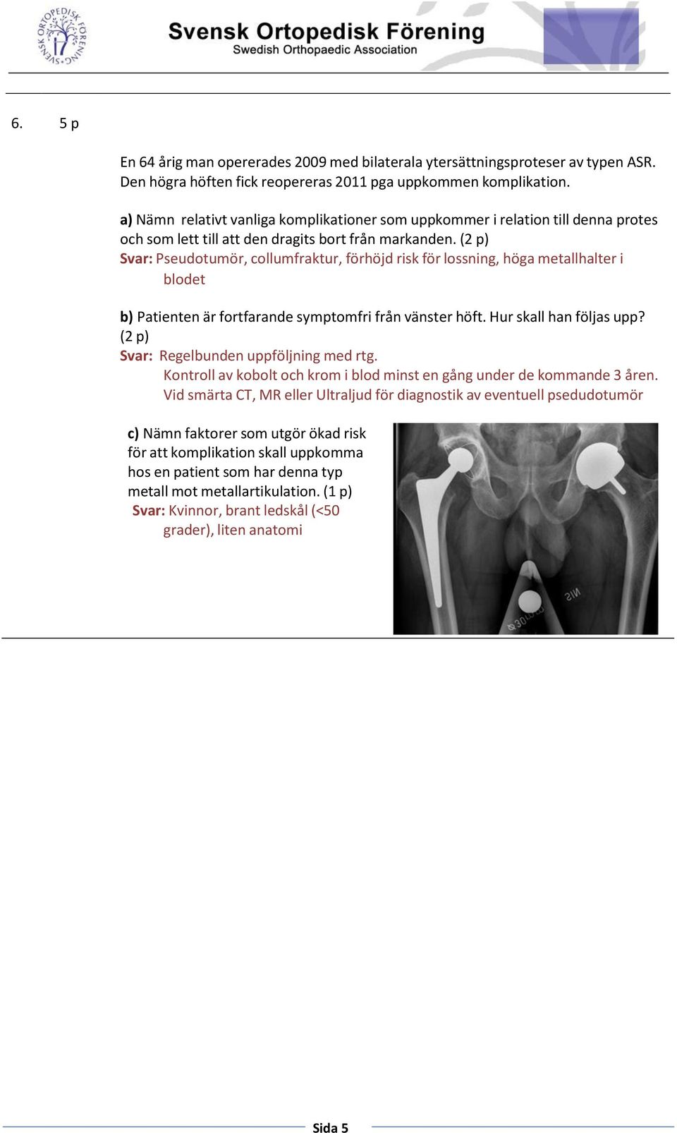 (2 p) Svar: Pseudotumör, collumfraktur, förhöjd risk för lossning, höga metallhalter i blodet b) Patienten är fortfarande symptomfri från vänster höft. Hur skall han följas upp?