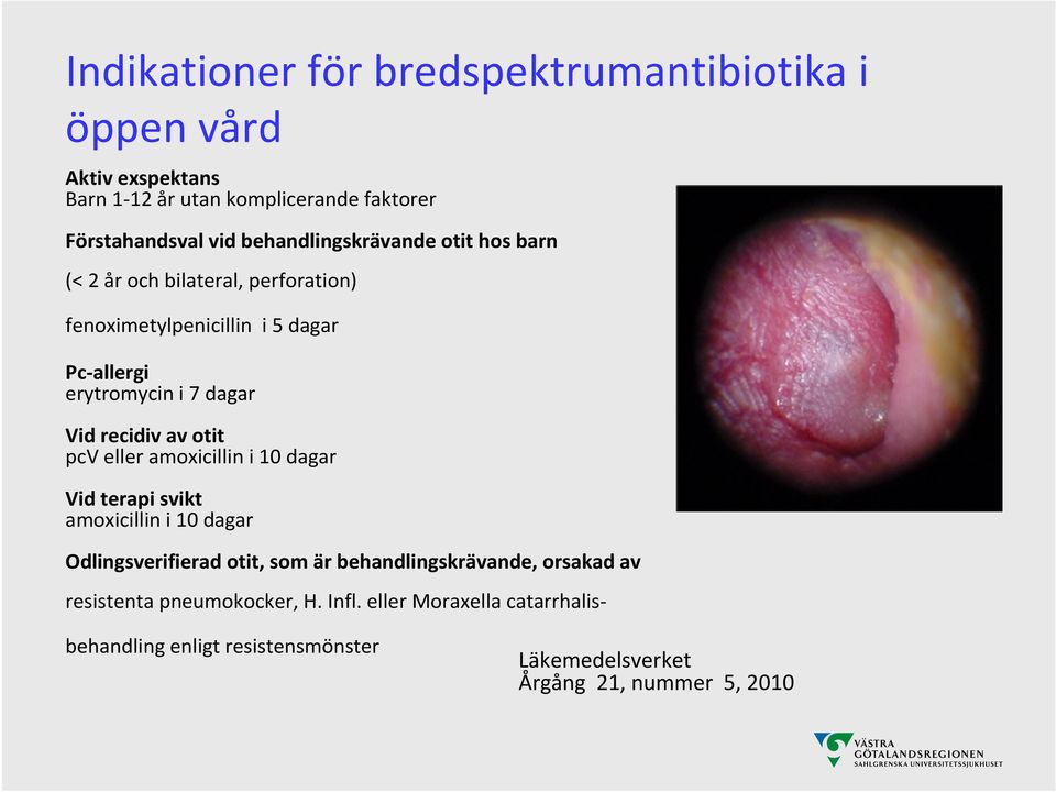 recidiv av otit pcv eller amoxicillin i 10 dagar Vid terapi svikt amoxicillin i 10 dagar Odlingsverifierad otit, som är