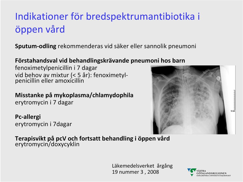 fenoximetylpenicillin eller amoxicillin Misstanke på mykoplasma/chlamydophila erytromycin i 7 dagar Pc allergi