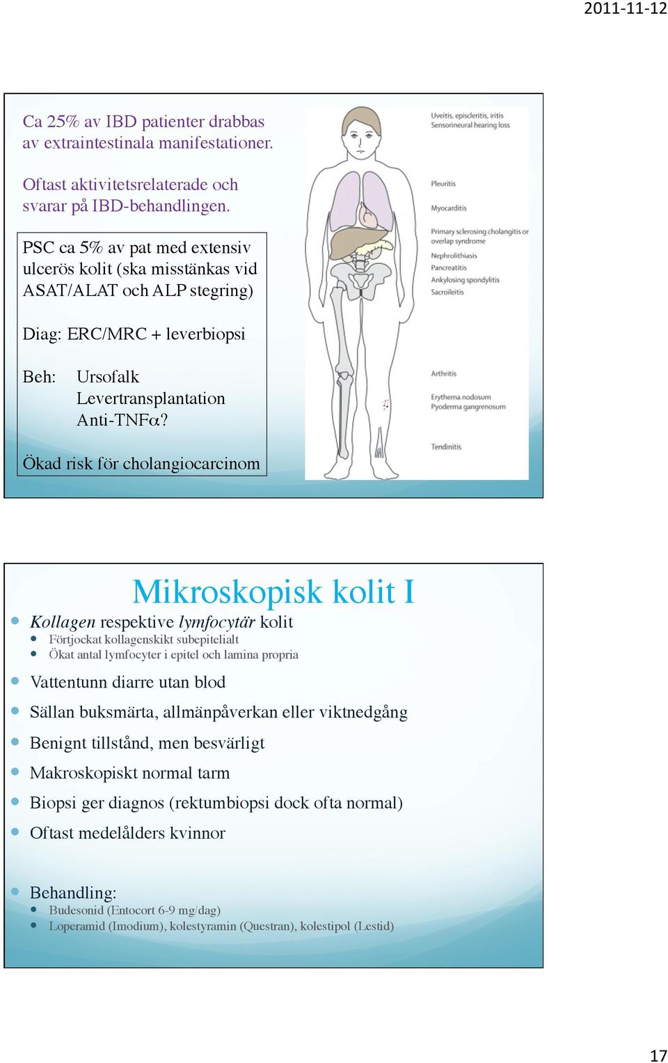 Ökad risk för cholangiocarcinom Mikroskopisk kolit I Kollagen respektive lymfocytär kolit Förtjockat kollagenskikt subepitelialt Ökat antal lymfocyter i epitel och lamina propria Vattentunn diarre