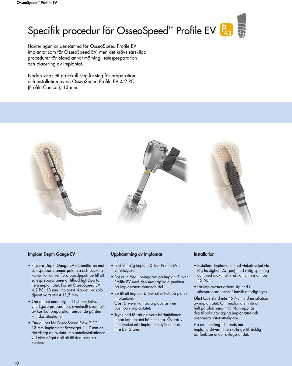 Implant Depth Gauge EV Placera Depth Gauge EV djupmätaren mot sätespreparationens palatala och buckala kanter för att verifiera borrdjupet.