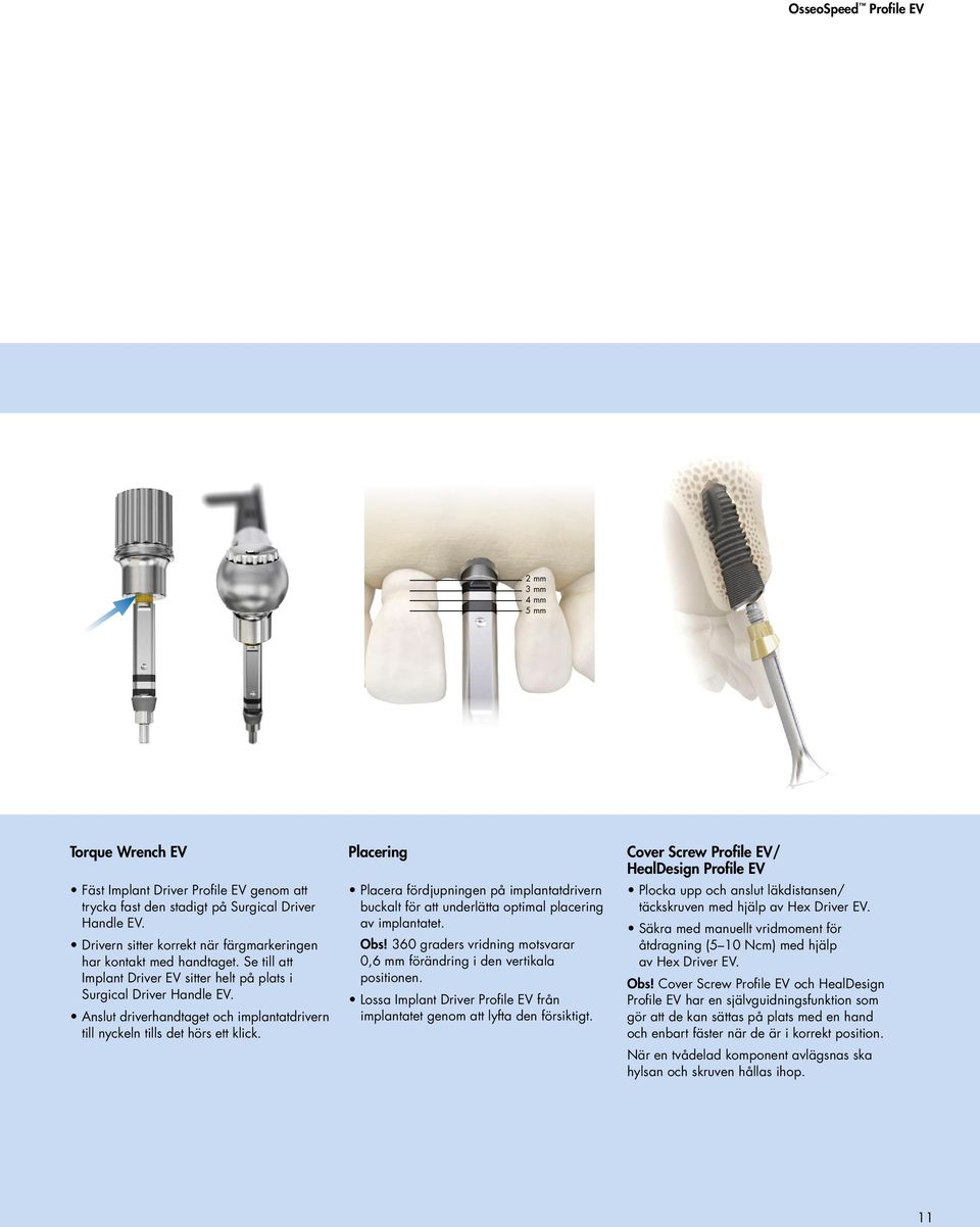 Anslut driverhandtaget och implantatdrivern till nyckeln tills det hörs ett klick. Placering Placera fördjupningen på implantatdrivern buckalt för att underlätta optimal placering av implantatet. Obs!