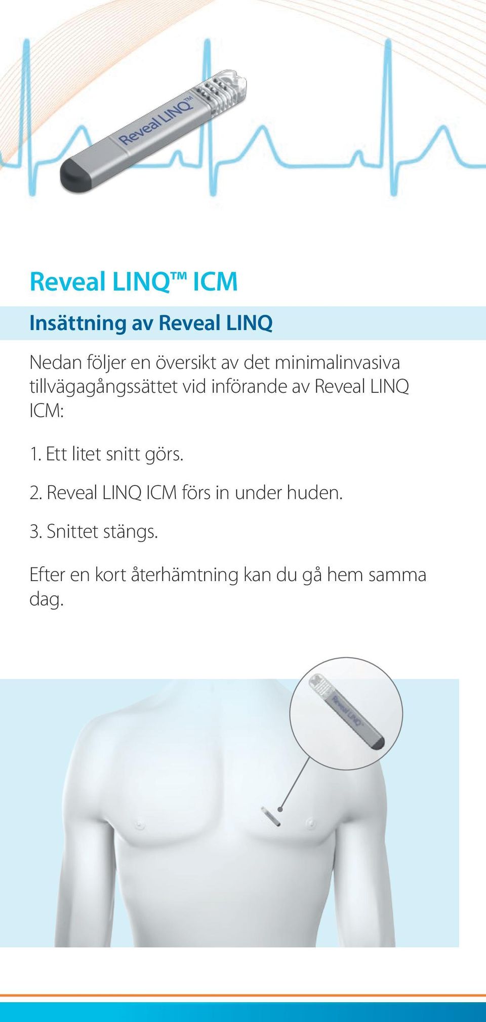 ICM: 1. Ett litet snitt görs. 2. Reveal LINQ ICM förs in under huden.