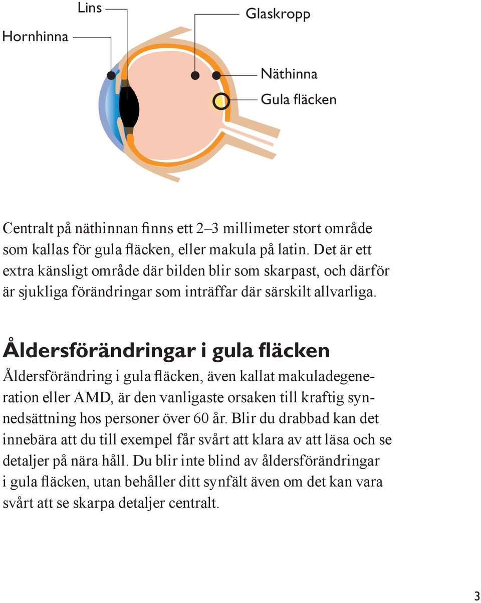 Åldersförändringar i gula fläcken Åldersförändring i gula fläcken, även kallat makuladegeneration eller AMD, är den vanligaste orsaken till kraftig synnedsättning hos personer över 60 år.