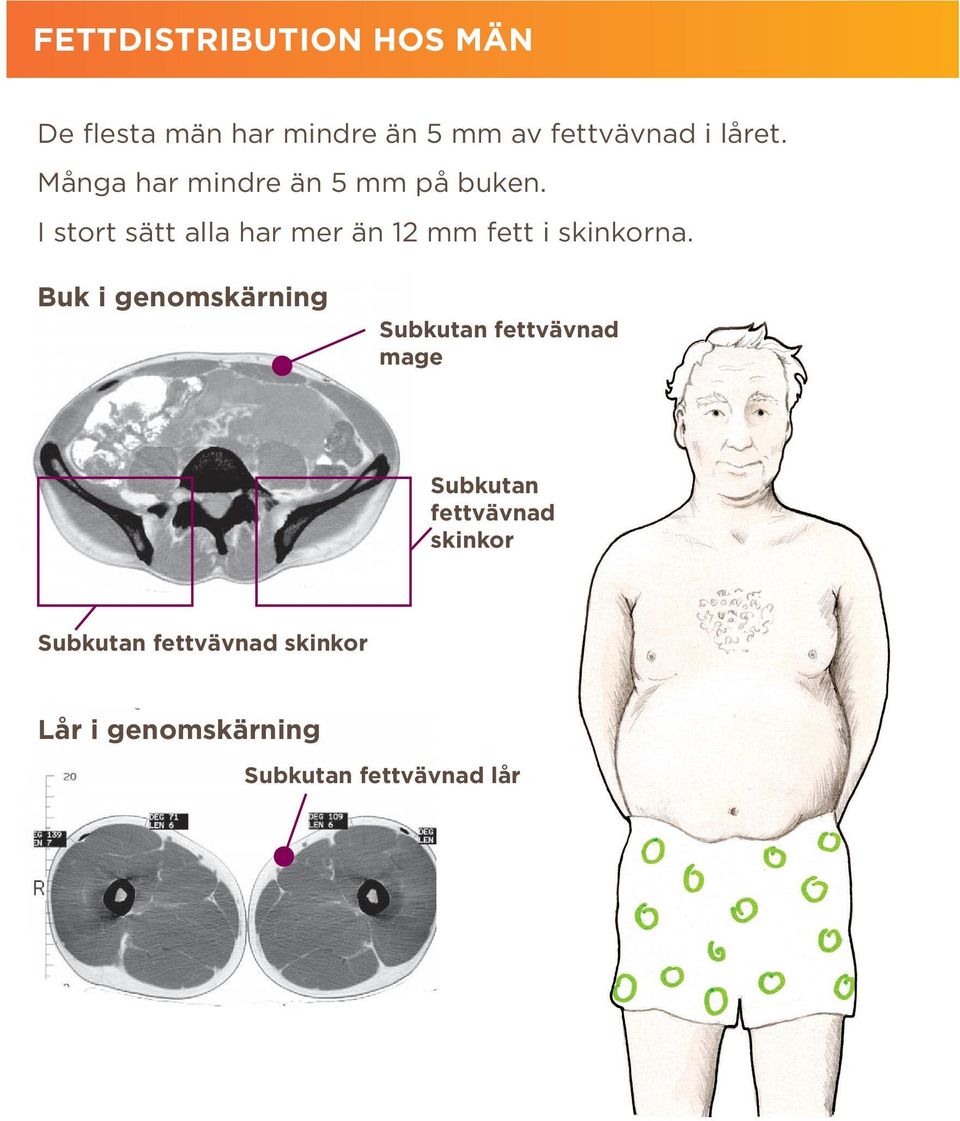 I stort sätt alla har mer än 12 mm fett i skinkorna.