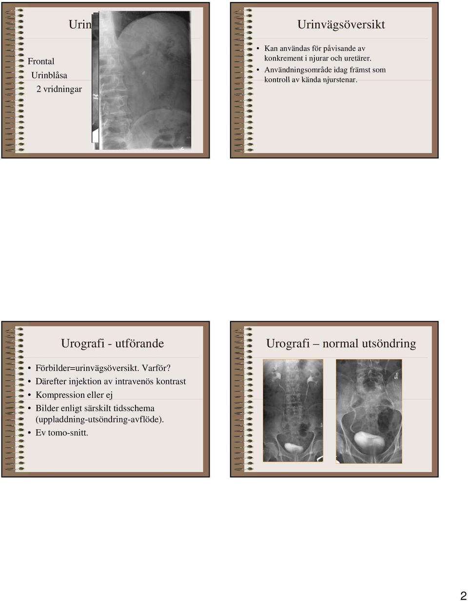 Urografi - utförande Urografi normal utsöndring Förbilder=urinvägsöversikt. Varför?
