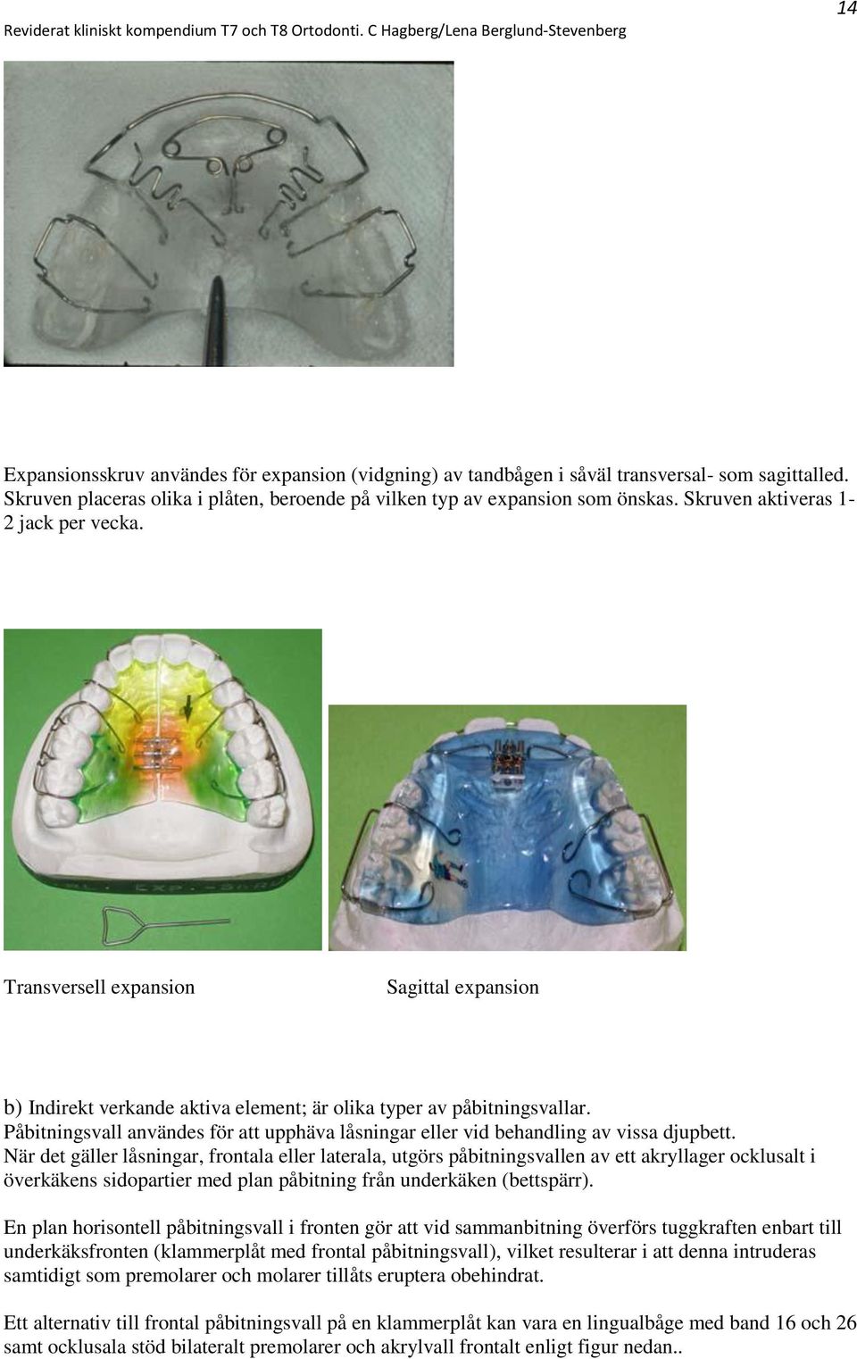 Påbitningsvall användes för att upphäva låsningar eller vid behandling av vissa djupbett.