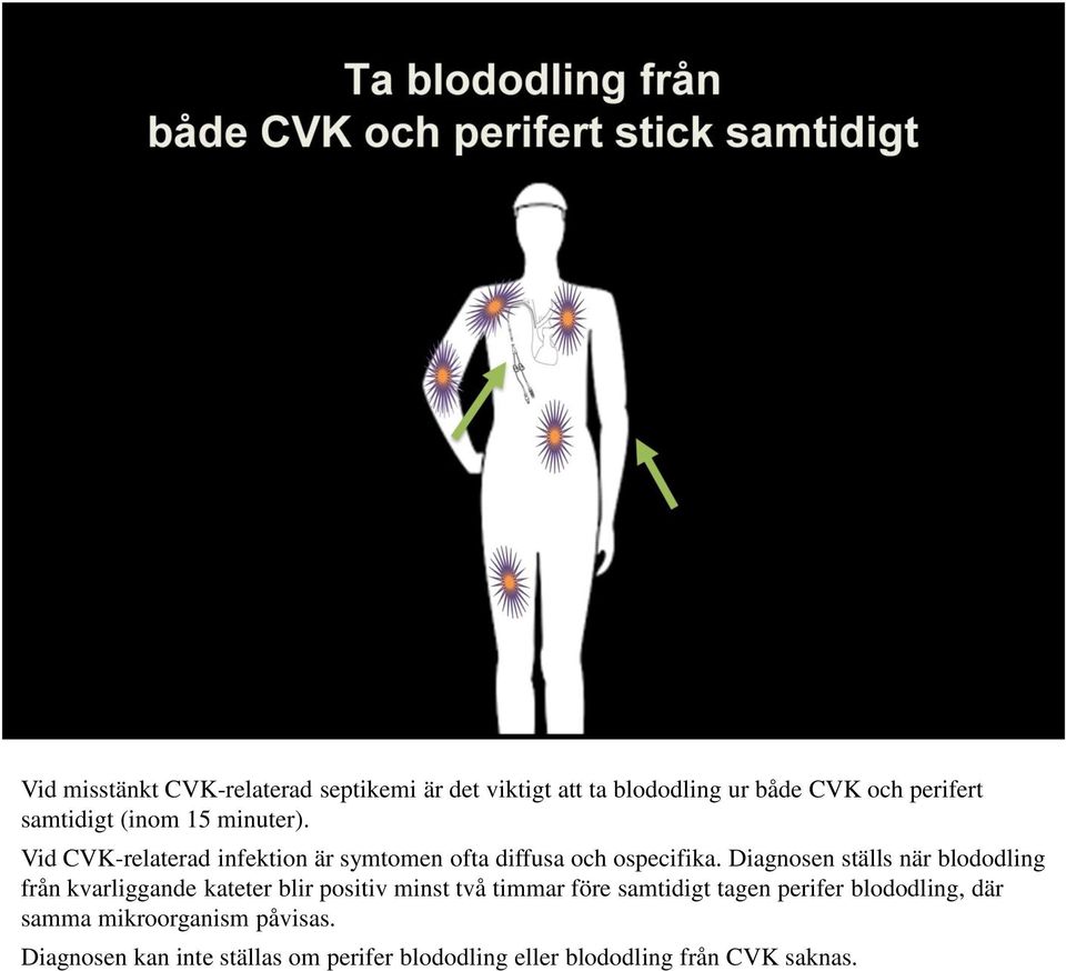 Diagnosen ställs när blododling från kvarliggande kateter blir positiv minst två timmar före samtidigt tagen