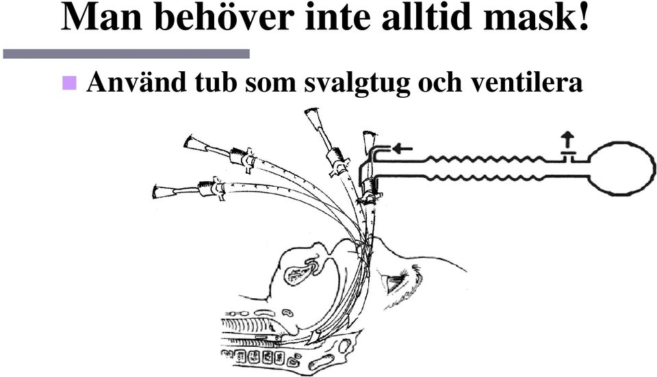 Använd tub som