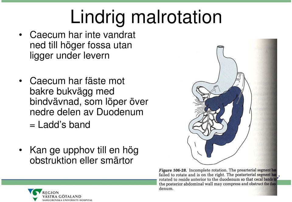 bukvägg med bindvävnad, som löper över nedre delen av