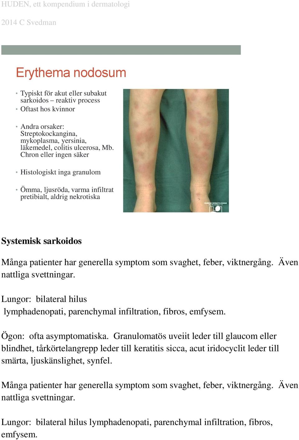 viktnergång. Även nattliga svettningar. Lungor: bilateral hilus lymphadenopati, parenchymal infiltration, fibros, emfysem. Ögon: ofta asymptomatiska.