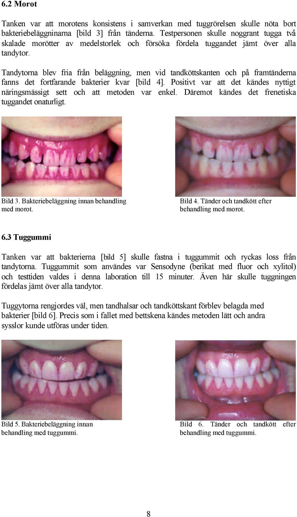 Tandytorna blev fria från beläggning, men vid tandköttskanten och på framtänderna fanns det fortfarande bakterier kvar [bild 4].