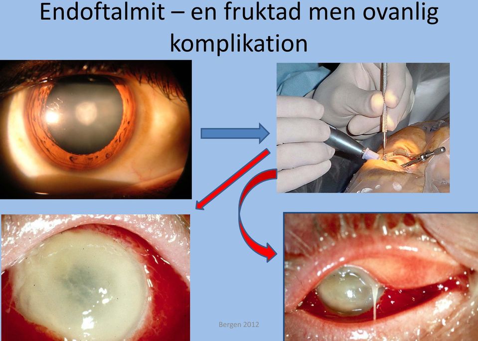 men ovanlig