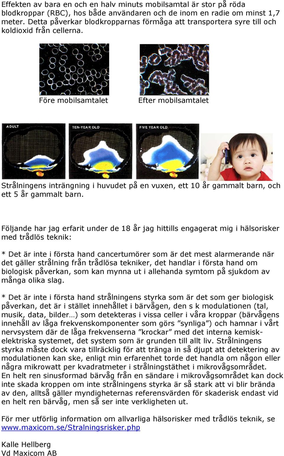 Före mobilsamtalet Efter mobilsamtalet Strålningens inträngning i huvudet på en vuxen, ett 10 år gammalt barn, och ett 5 år gammalt barn.