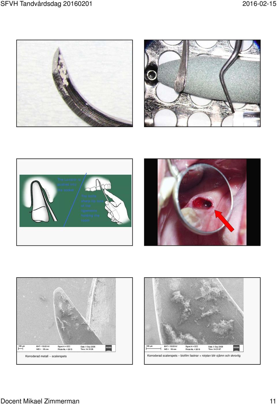 -- scalerspets Korroderad scalerspets biofilm fastnar +