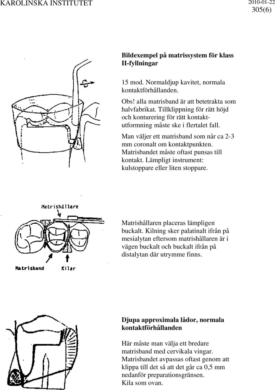 Matrisbandet måste oftast punsas till kontakt. Lämpligt instrument: kulstoppare eller liten stoppare. Matrishållaren placeras lämpligen buckalt.