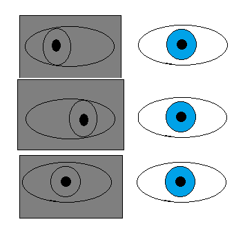 1.4 Heterofori Heterofori är en latent deviation av ögonen som enbart syns när fusionen mellan ögonen bryts.