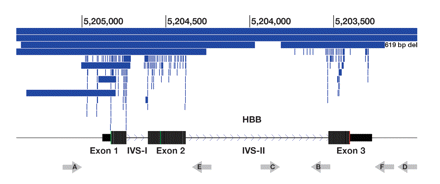 β-thalassemi Herlev Karolinska, Klinisk genetik Sekvensering