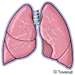 KOL Kronisk obstruktiv lungsjukdom Inledning Vid KOL finns ett bestående luftflödeshinder i de mindre luftvägarna.