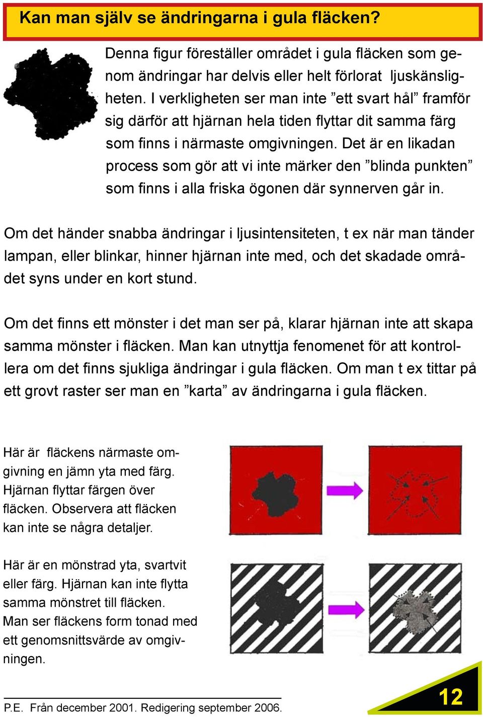 Det är en likadan process som gör att vi inte märker den blinda punkten som finns i alla friska ögonen där synnerven går in.