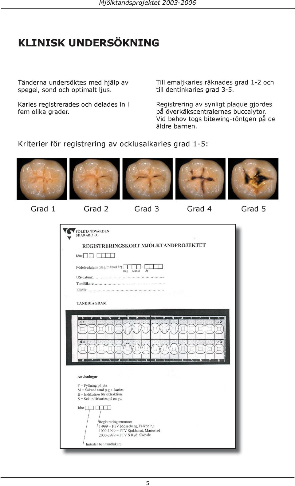 Kriterier för registrering av ocklusalkaries grad 1-5: KRITERIER FOR REGISTRERING AV OKKLUSALKARIES GRAD 1 (O1) Karies karakterisert ved en hvitlig/brunlig misfarging i emaljen uten substanstap